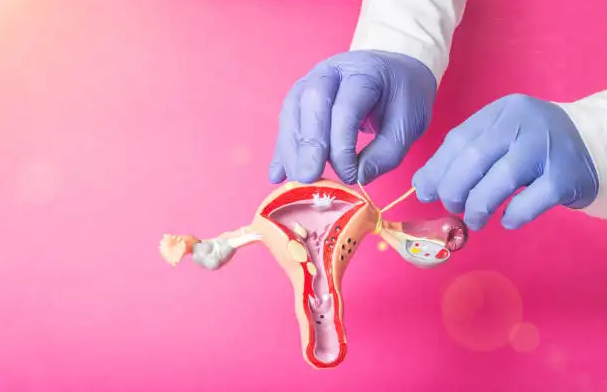 VIDEO Legarea trompelor uterine cum se realizează AICIMAMI